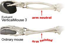 twisted arm VerticalMouse
